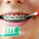 Braces dentist dental care emergency appointment having woman small treatment teeth tooth preview